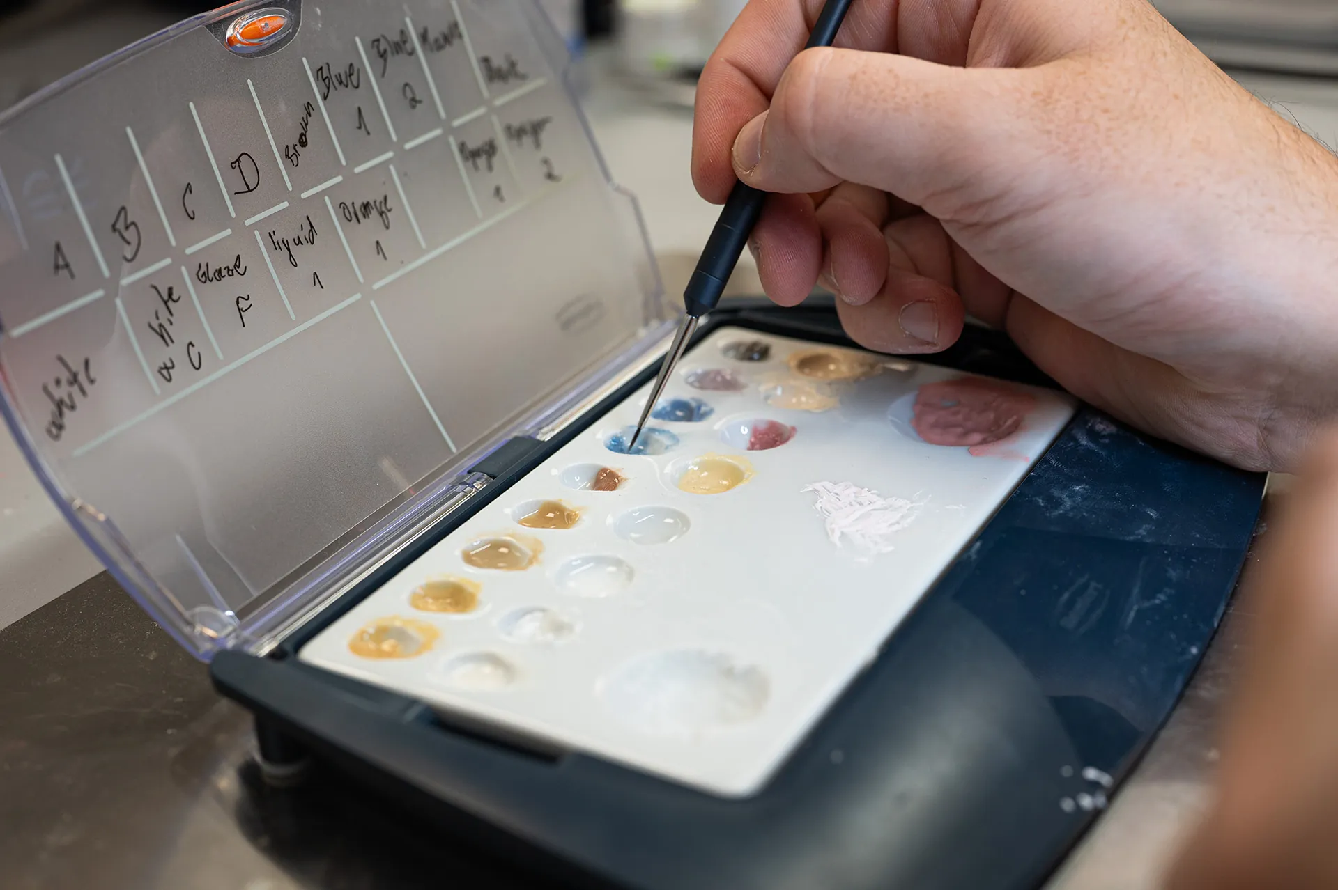Výber odtieňa zubnej náhrady v laboratóriu