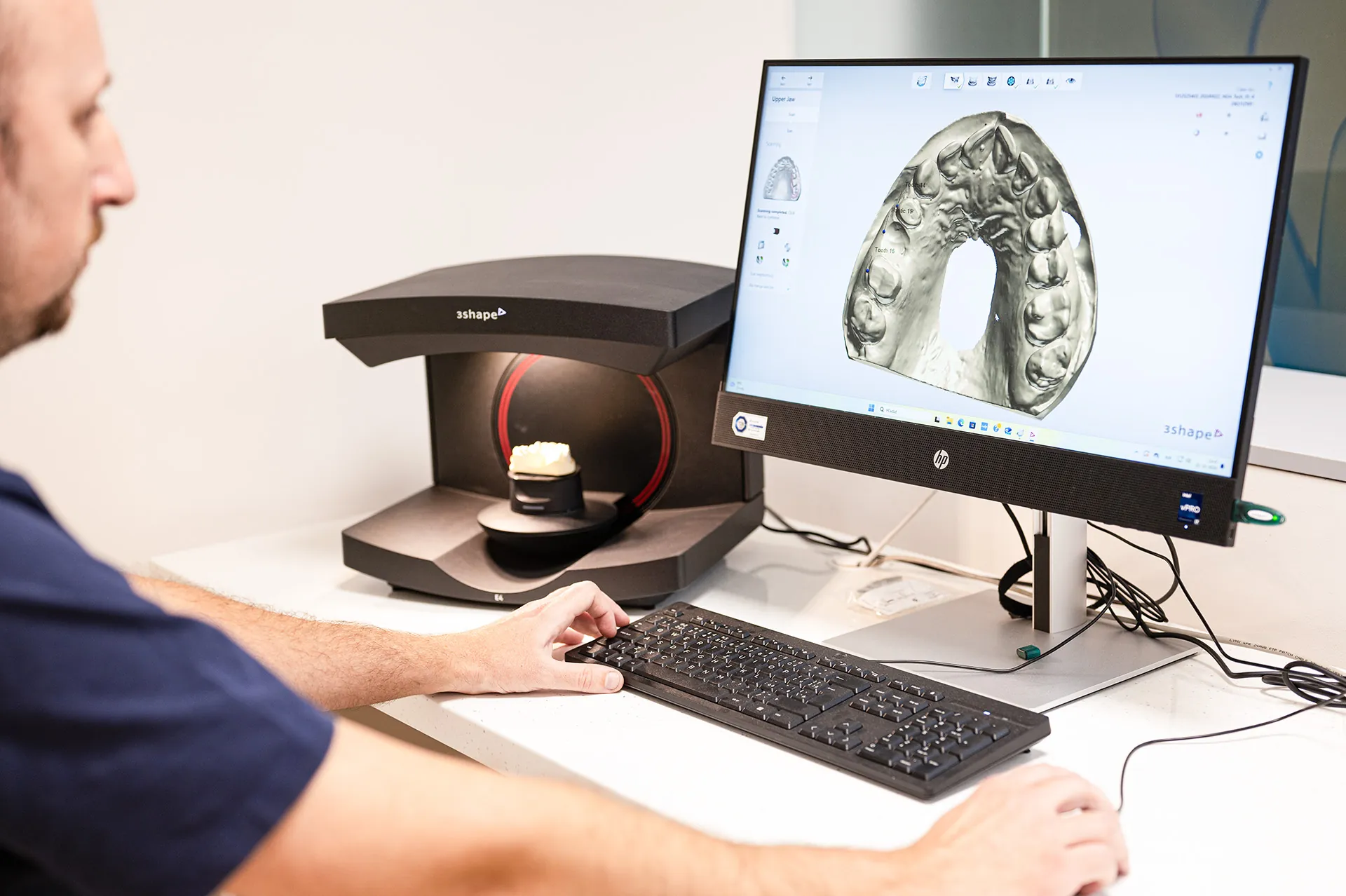 Digitálny návrh zubnej náhrady v laboratóriu