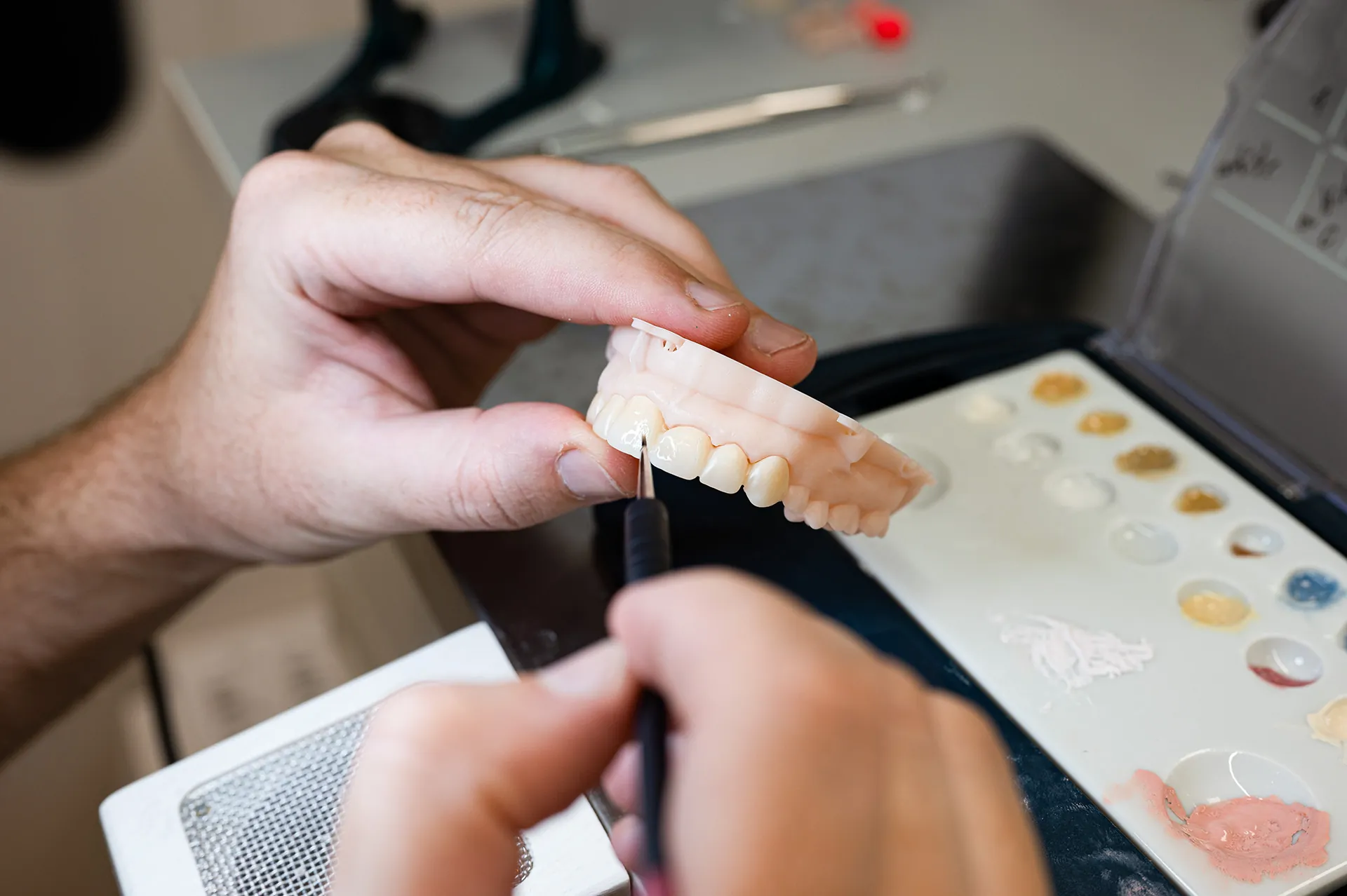 Výroba snímateľnej protézy v laboratóriu